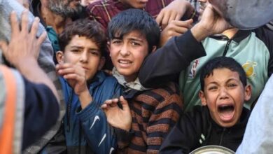 مصادر طبية: 67 طفلًا توفوا بسبب سوء التغذية في غزة
